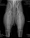 Radiograph @ 42 months