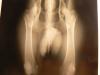 X rays and pictures