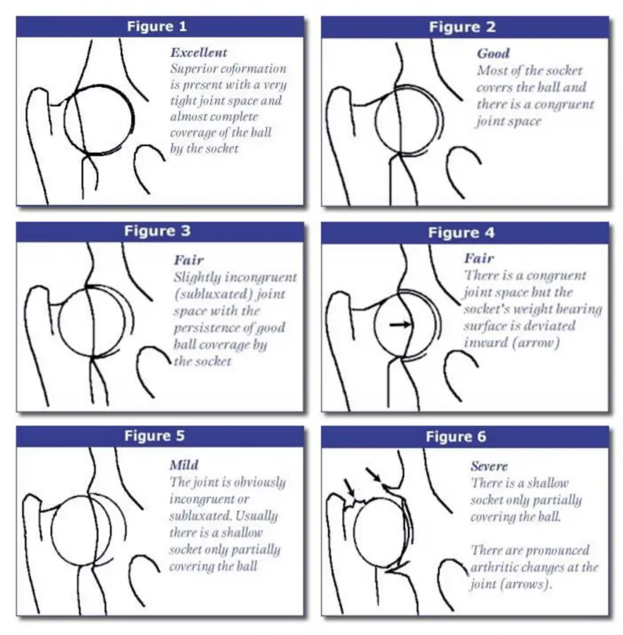 guide to interpreting hip x rays page 1 hipp vs holle chart