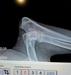 Halo Left Elbow