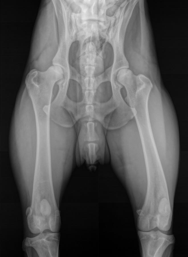 Ofa hips and sales elbows