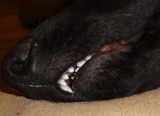 Will This Overbite Correct Itself Page 1